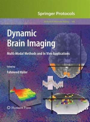 Dynamic Brain Imaging: Multi-Modal Methods and In Vivo Applications de Fahmeed Hyder