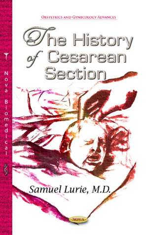 History of Cesarean Section de Samuel Lurie