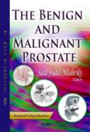 Benign & Malignant Prostate de Said Fadel Mishriki