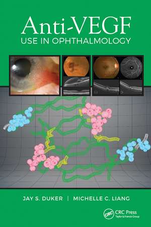 Anti-VEGF Use in Ophthalmology de Jay Duker