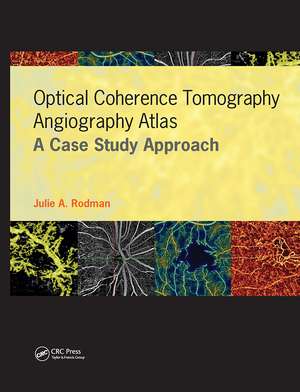 Optical Coherence Tomography Angiography Atlas: A Case Study Approach de Julie Rodman