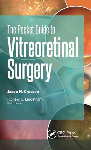 The Pocket Guide to Vitreoretinal Surgery de Jason Crosson