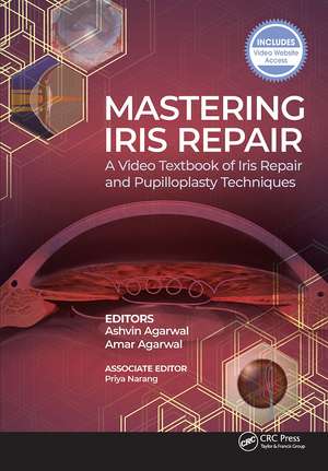 Mastering Iris Repair: A Video Textbook of Iris Repair and Pupilloplasty Techniques de Ashvin Agarwal