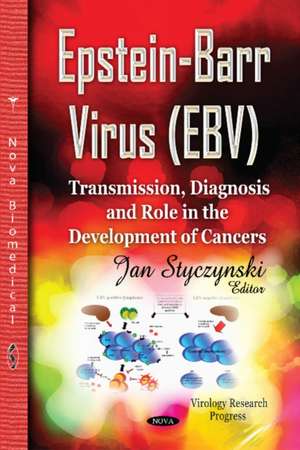 Epstein-Barr Virus (EBV) de STYCZYNSKI J