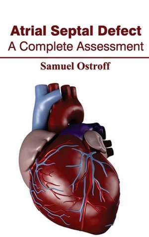 Atrial Septal Defect de Samuel Ostroff