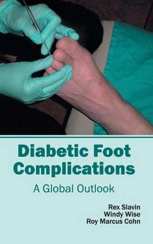 Diabetic Foot Complications de Roy Marcus Cohn