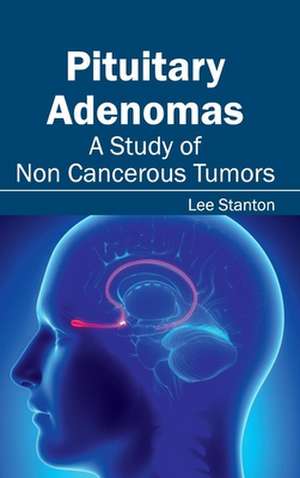 Pituitary Adenomas de Lee Stanton