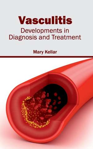 Vasculitis de Mary Kellar