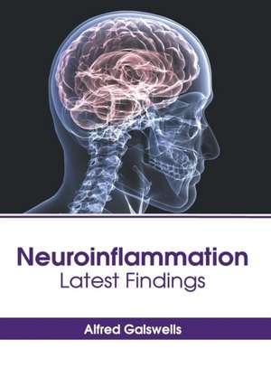 Neuroinflammation: Latest Findings de Alfred Galswells