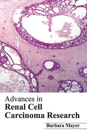 Advances in Renal Cell Carcinoma Research de Barbara Mayer