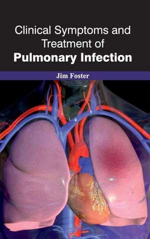 Clinical Symptoms and Treatment of Pulmonary Infection de Jim Foster