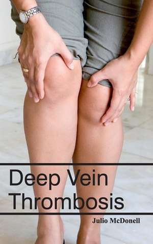 Deep Vein Thrombosis de Julio McDonell