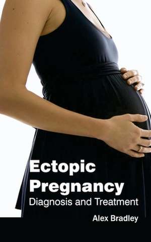 Ectopic Pregnancy de Alex Bradley