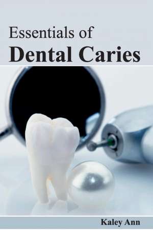 Essentials of Dental Caries de Kaley Ann