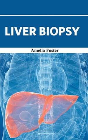 Liver Biopsy de Amelia Foster