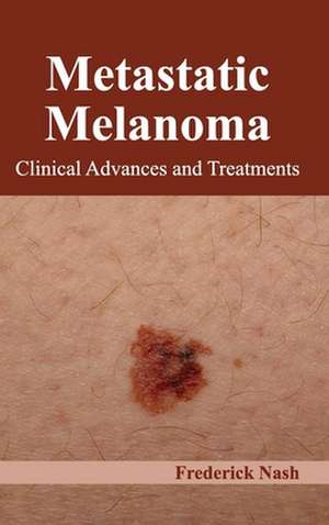 Metastatic Melanoma de Frederick Nash