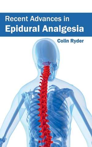 Recent Advances in Epidural Analgesia de Colin Ryder