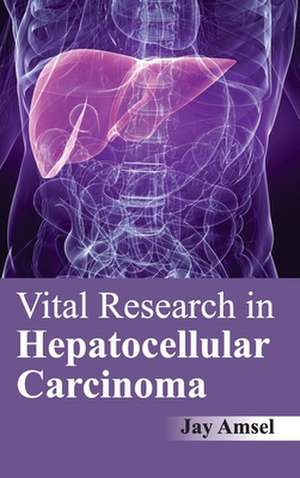 Vital Research in Hepatocellular Carcinoma de Jay Amsel