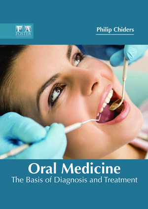 Oral Medicine de Chiders, Philip