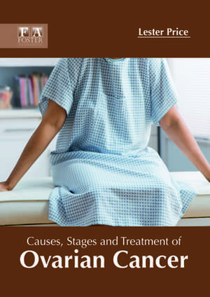 Causes, Stages and Treatment of Ovarian Cancer de Lester Price