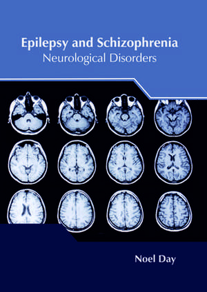 Epilepsy and Schizophrenia de Day, Noel