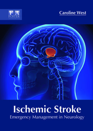 Ischemic Stroke de Caroline West