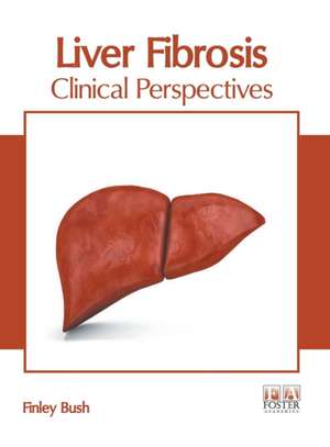 Liver Fibrosis: Clinical Perspectives de Finley Bush