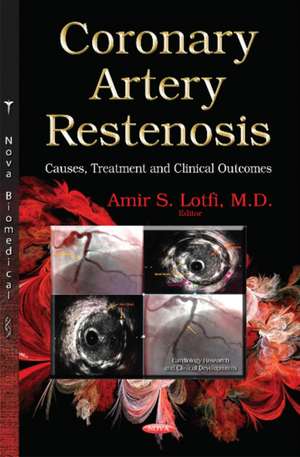 Coronary Artery Restenosis de Amir S. Lotfi