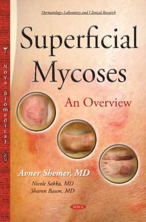 Superficial Mycoses de Avner Shemer