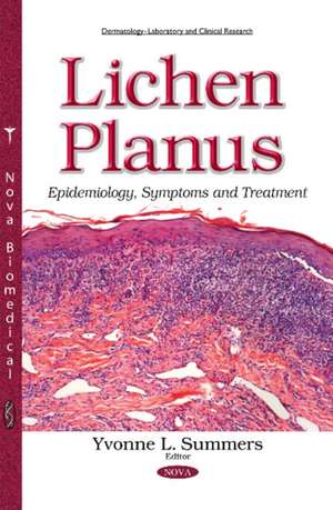 Lichen Planus: Epidemiology, Symptoms & Treatment de Yvonne L Summers