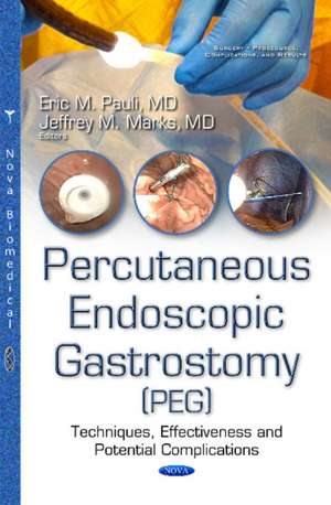 Percutanous Endoscopic Gastrostomy (PEG): Techniques, Effectiveness & Potential Complications de Eric Mark Pauli