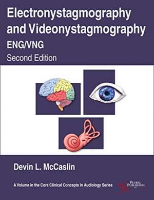 Electronystagmography/Videonystagmography (ENG/VNG) de Devin L. McCaslin