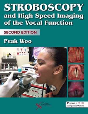 Stroboscopy and High Speed Imaging of the Vocal Function de Peak Woo