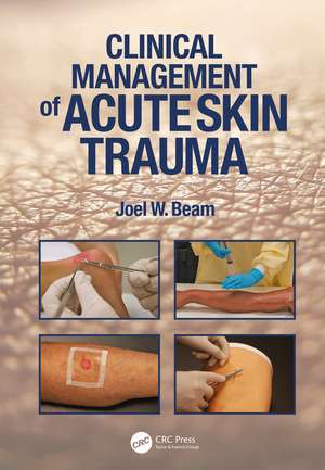 Clinical Management of Acute Skin Trauma de Joel W. Beam