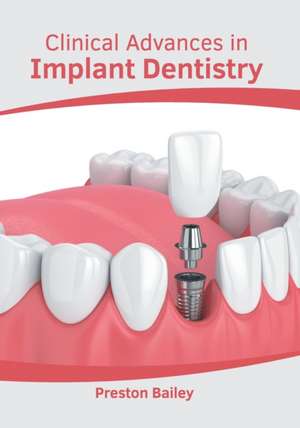 Clinical Advances in Implant Dentistry de Preston Bailey