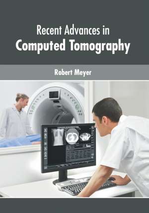 Recent Advances in Computed Tomography de Robert Meyer