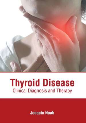 Thyroid Disease: Clinical Diagnosis and Therapy de Joaquin Noah