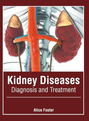 Kidney Diseases: Diagnosis and Treatment de Alice Foster