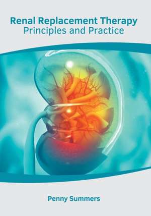 Renal Replacement Therapy: Principles and Practice de Penny Summers