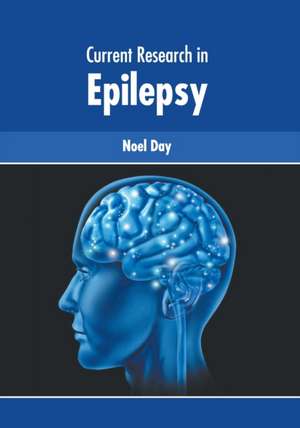 Current Research in Epilepsy de Noel Day