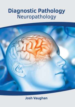 Diagnostic Pathology: Neuropathology de Josh Vaughan