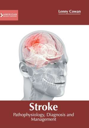 Stroke: Pathophysiology, Diagnosis and Management de Lenny Cowan