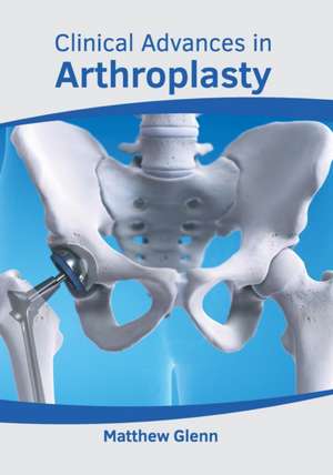 Clinical Advances in Arthroplasty de Matthew Glenn