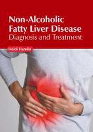 Non-Alcoholic Fatty Liver Disease: Diagnosis and Treatment de Heidi Hamlin