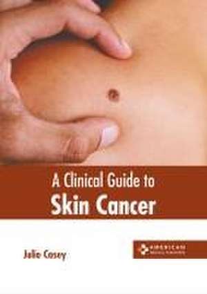 A Clinical Guide to Skin Cancer de Julio Casey