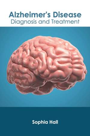 Alzheimer's Disease: Diagnosis and Treatment de Sophia Hall