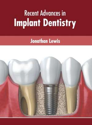 Recent Advances in Implant Dentistry de Jonathan Lewis