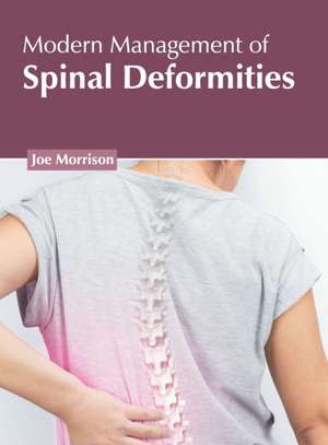 Modern Management of Spinal Deformities de Joe Morrison