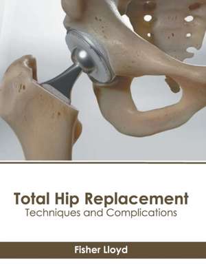 Total Hip Replacement: Techniques and Complications de Fisher Lloyd