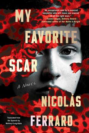 My Favorite Scar de Nicolas Ferraro